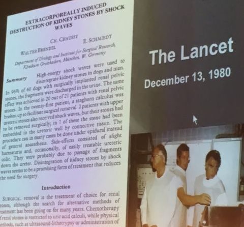 37 años de la primera litotricia extracorpórea por ondas de choque
