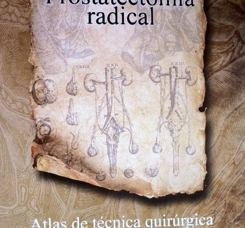 Nuevo Libro Sobre Prostatectomia Radical